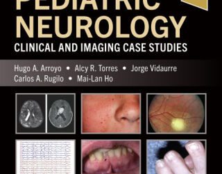 Pediatric Neurology