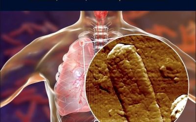 Pili in Mycobacterium Tuberculosis: Structure, Function, and Therapeutic Advances 1st Edition