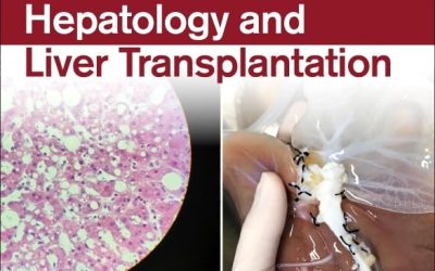 Regenerative Hepatology and Liver Transplantation (Volume 2) (Regenerative and Transplant Medicine, Volume 2) 1st Edition