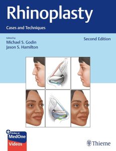Rhinoplasty: Cases and Techniques 2nd Edition