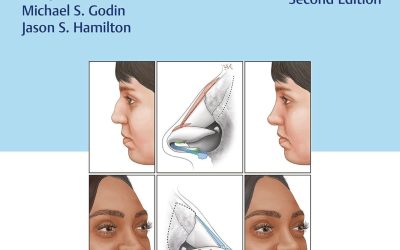 Rhinoplasty: Cases and Techniques 2nd Edition