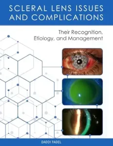 Scleral Lens Issues and Complications