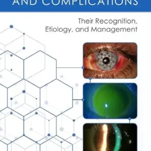 Scleral Lens Issues and Complications