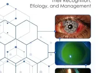 Scleral Lens Issues and Complications