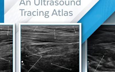 Technical Ultrasound Handbook – Muscles & Nerves: An Ultrasound Tracing Atlas (Series 1)