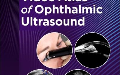 Video Atlas of Ophthalmic Ultrasound