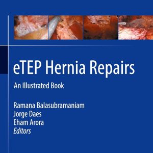 eTEP Hernia Repairs: An Illustrated Book
