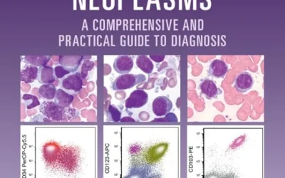 Flow Cytometry in Hematolymphoid Neoplasms: A Comprehensive and Practical Guide to Diagnosis