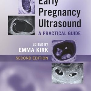Early Pregnancy Ultrasound, 2nd edition