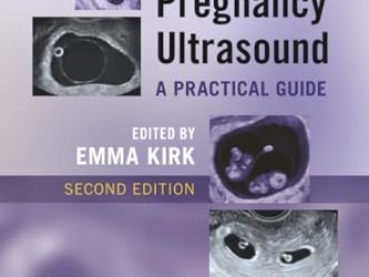 Early Pregnancy Ultrasound, 2nd edition