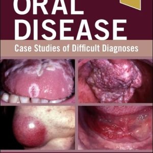 Oral Disease: Case Studies of Difficult Diagnoses