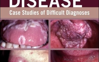 Oral Disease: Case Studies of Difficult Diagnoses