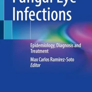 Fungal Eye Infections: Epidemiology, Diagnosis and Treatment