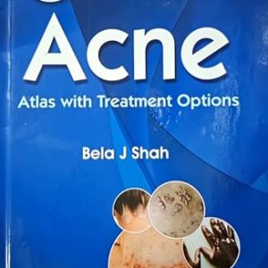 Acne: Atlas With Treatment Option, 2nd edition