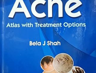 Acne: Atlas With Treatment Option, 2nd edition