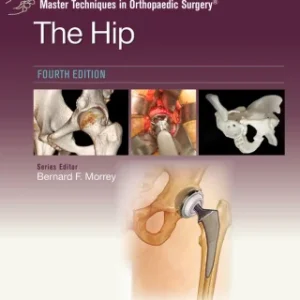 Master Techniques in Orthopaedic Surgery: The Hip, 4th Edition