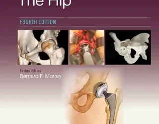 Master Techniques in Orthopaedic Surgery: The Hip, 4th Edition