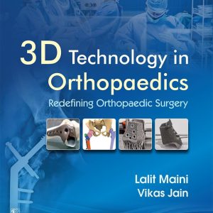 3D Technology in Orthopedics