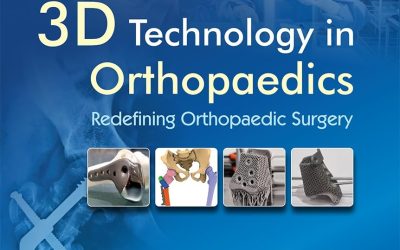 3D Technology in Orthopedics