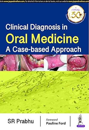 Clinical Diagnosis In Oral Medicine