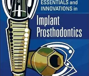 Essentials and Innovations in Implant Prosthodontics