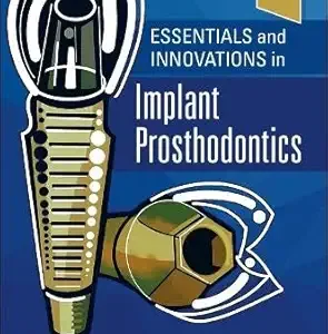 Essentials and Innovations in Implant Prosthodontics