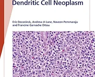 Fast Facts: Blastic Plasmacytoid Dendritic Cell Neoplasm: Shedding Light on a Rare Disease