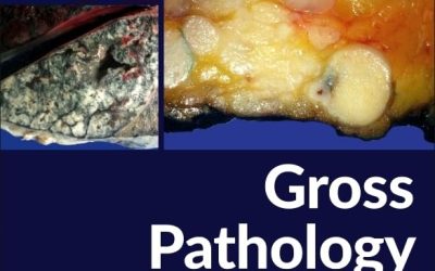 Gross Pathology Atlas: A Guide to Gross Specimens Evaluation