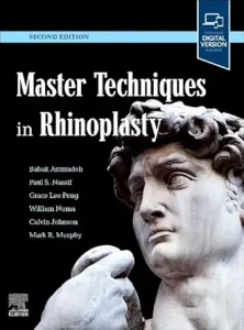 Master Techniques in Rhinoplasty, 2nd Edition