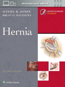 Master Techniques in Surgery: Hernia, 2nd Edition