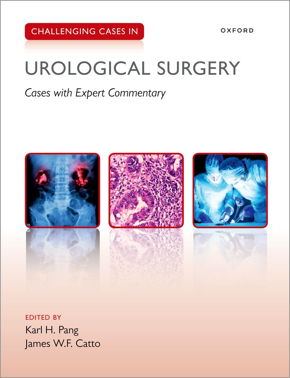 Challenging Cases in Urological Surgery, 1st Edition