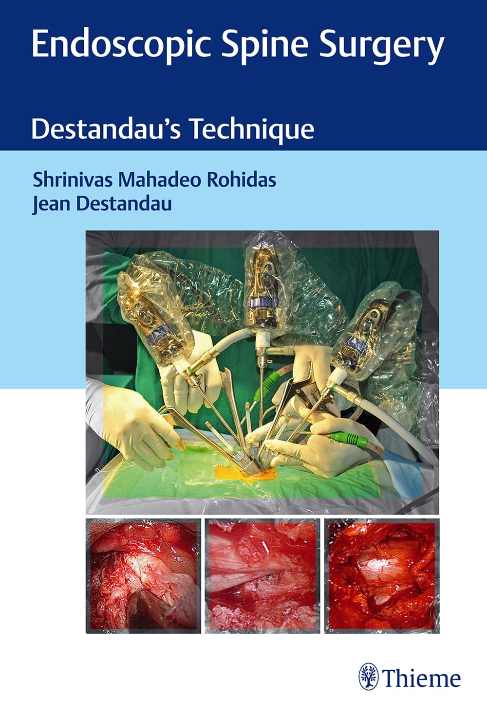 Endoscopic Spine Surgery Destandau's Technique, 1st Edition