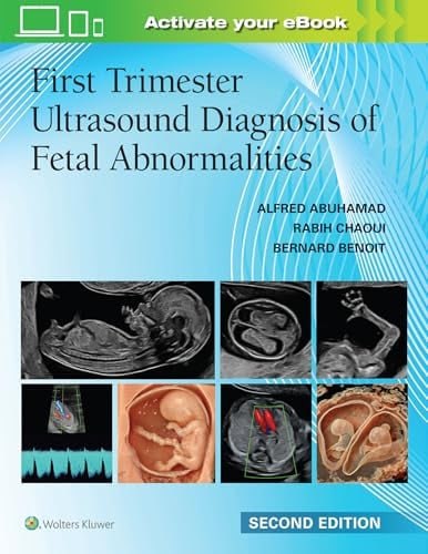 First-Trimester Ultrasound Diagnosis of Fetal Abnormalities and Complications