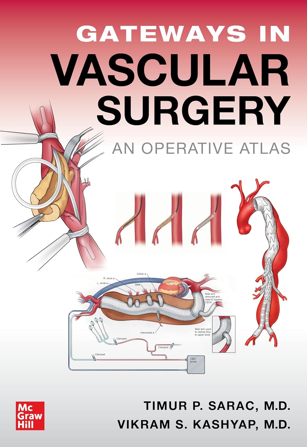 Gateways in Vascular Surgery An Operative Atlas