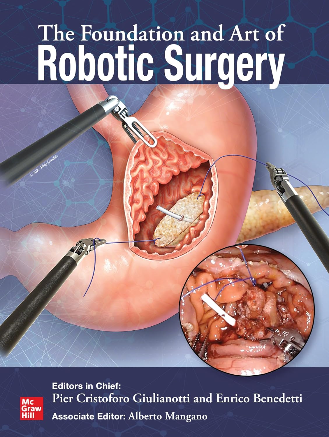 The Foundation and Art of Robotic Surgery, 1st Edition
