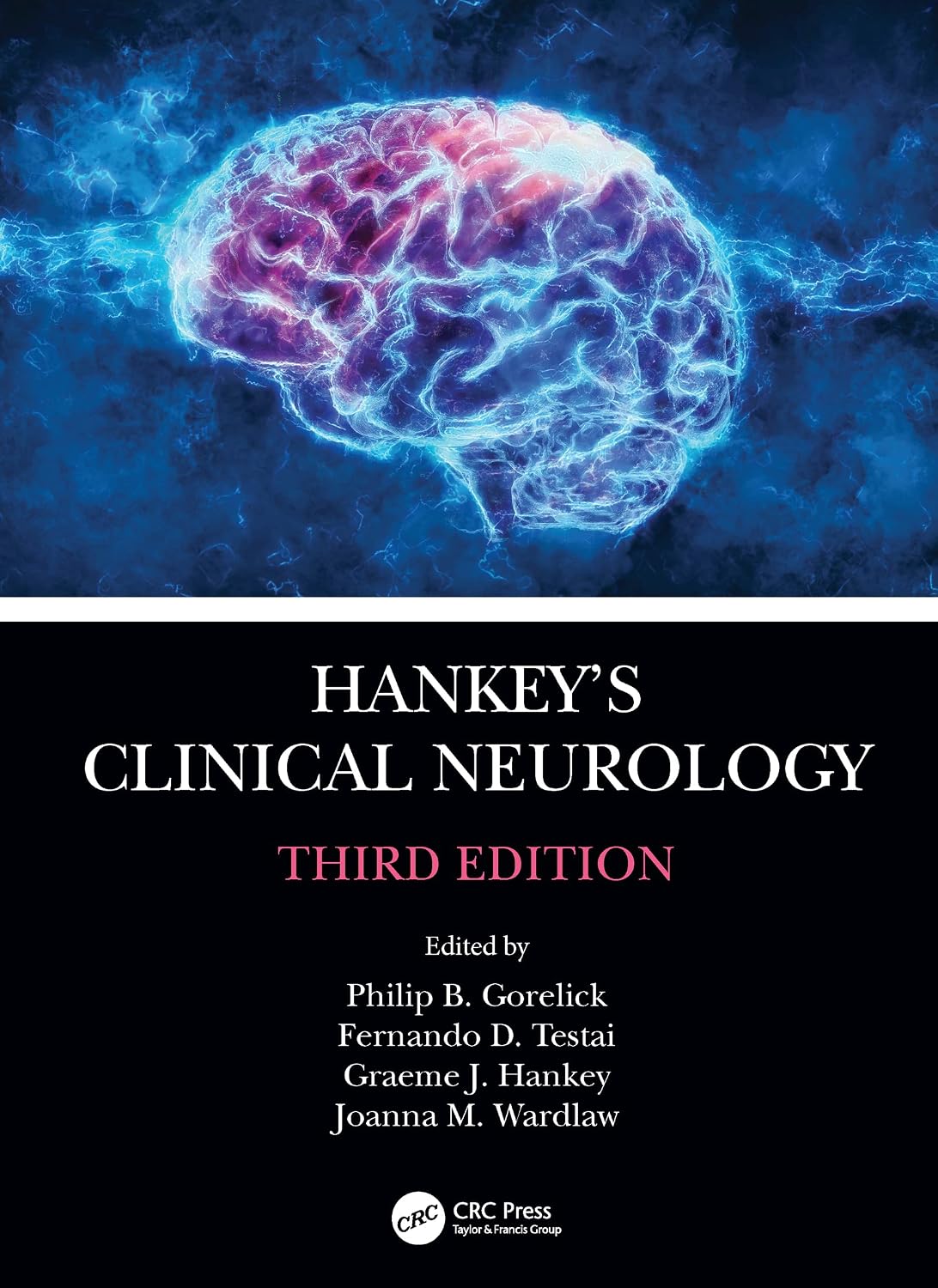 81NJaqbz1pL._SL1500_ Hankey's Clinical Neurology 3rd Edition