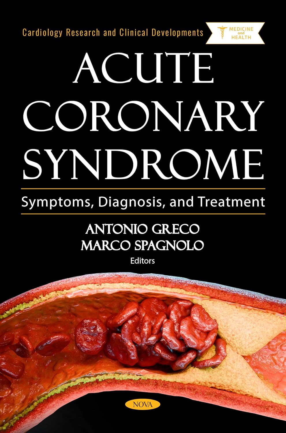 Acute Coronary Syndrome Symptoms, Diagnosis, and Treatment