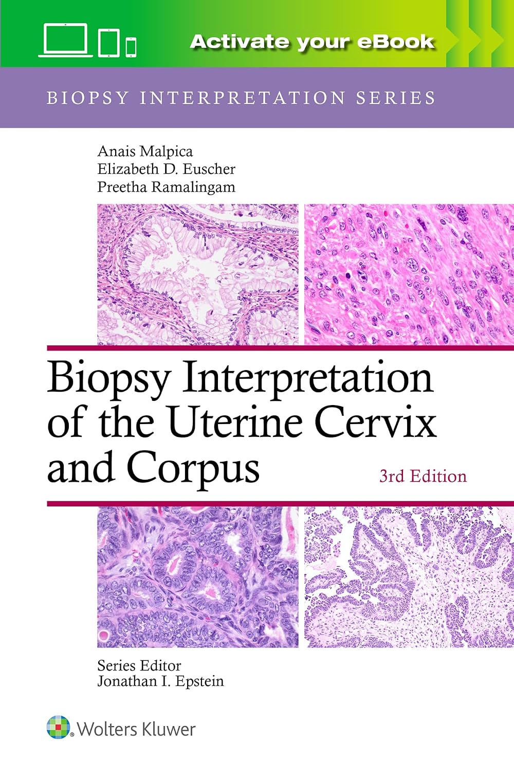 Biopsy Interpretation of the Uterine Cervix and Corpus 3rd Edition