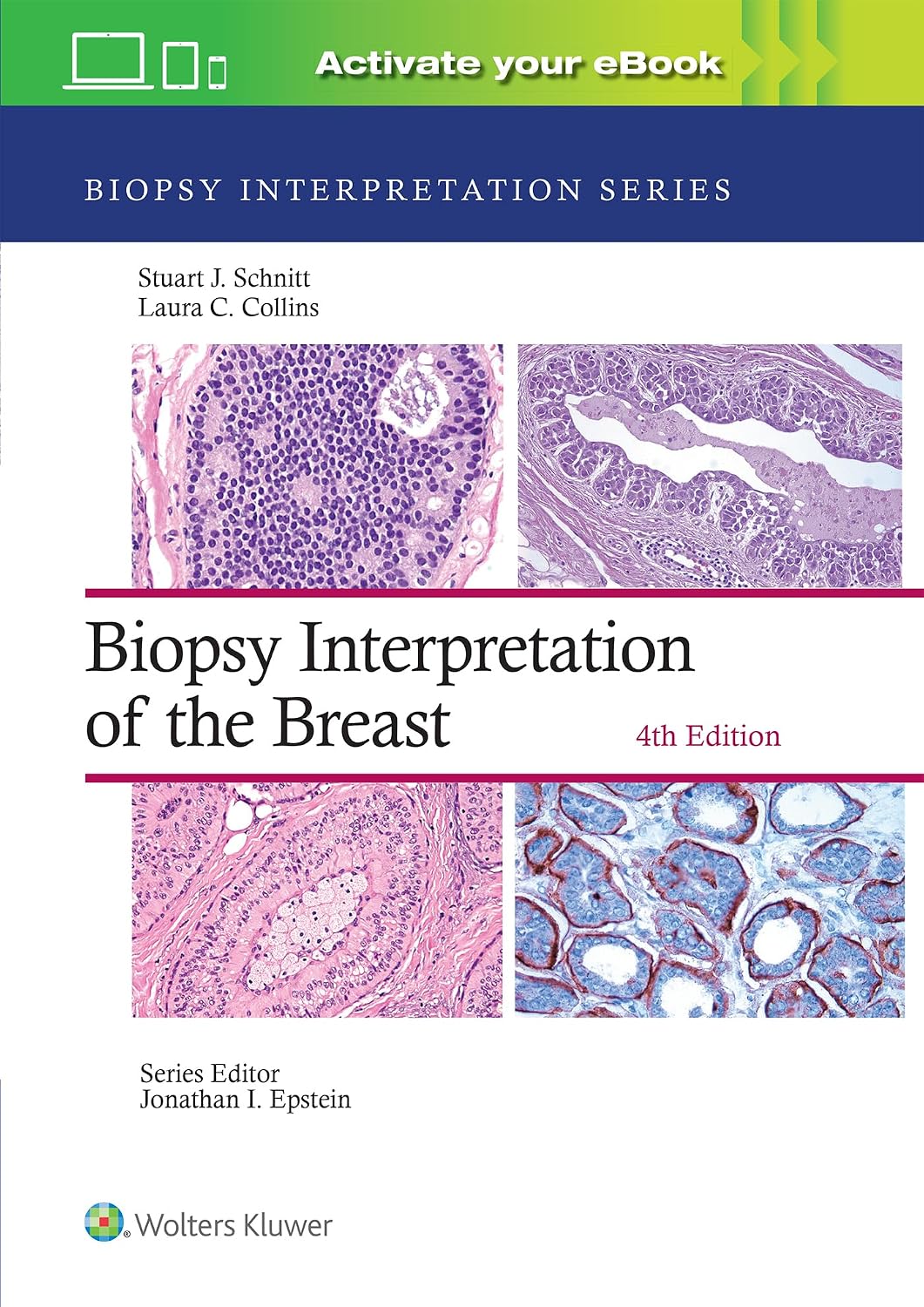 Biopsy interpretation breast 4th Edition