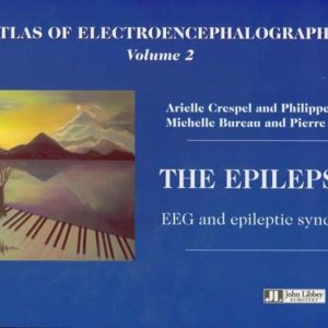 Atlas of Electroencephalography . The Epilepsies. EEG and Epileptic Syndromes Second Edition