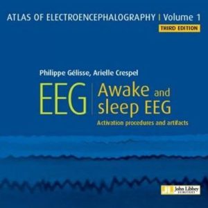 Atlas of Electroencephalography. Awake and sleep EEG. Activation procedures and artifacts Third Edition