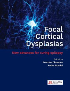 Focal Cortical Dysplasias: New advances for curing epilepsy