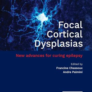 Focal Cortical Dysplasias: New advances for curing epilepsy