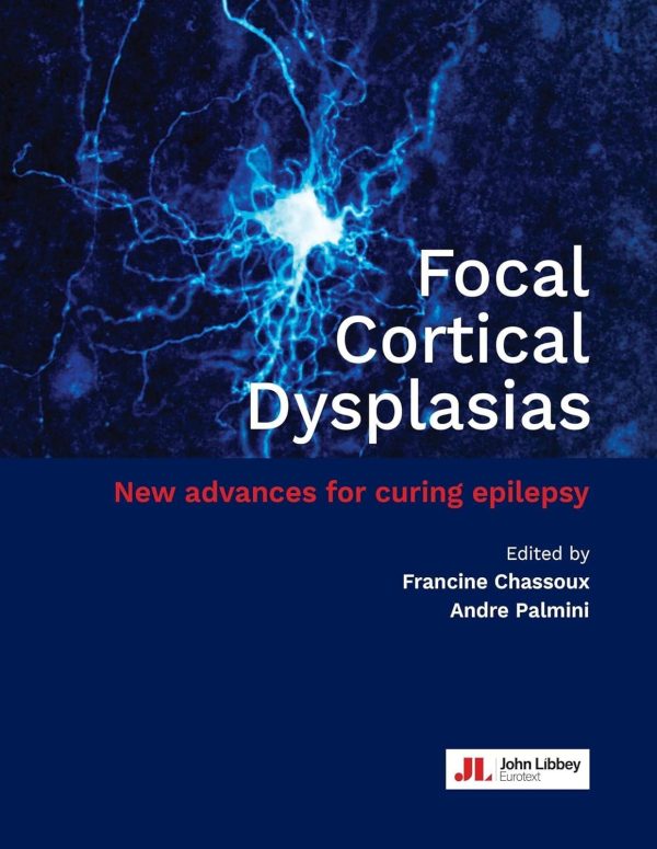 Focal Cortical Dysplasias: New advances for curing epilepsy