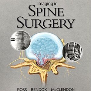 Imaging in Spine Surgery 1st Edition