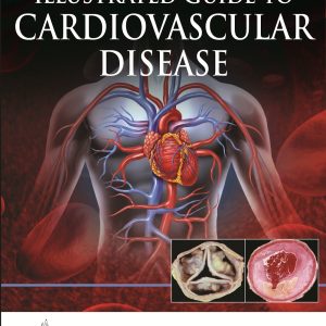 Illustrated Guide to Cardiovascular Disease 1st Edition