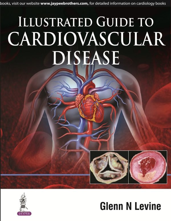 Illustrated Guide to Cardiovascular Disease 1st Edition