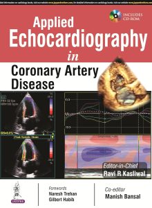 Applied Echocardiography in Coronary Artery Disease 1st Edition
