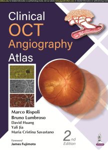 Clinical OCT Angiography Atlas Second Edition