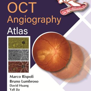 Clinical OCT Angiography Atlas Second Edition